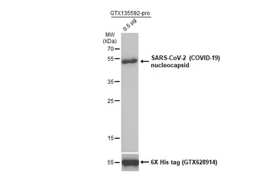 Anti-SARS-CoV / SARS-CoV-2 (COVID-19) Nucleocapsid antibody [6H3] used in Western Blot (WB). GTX632269