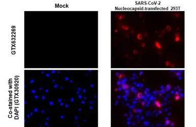 Anti-SARS-CoV / SARS-CoV-2 (COVID-19) Nucleocapsid antibody [6H3] used in IHC-P (cell pellet) (IHC-P (cell pellet)). GTX632269