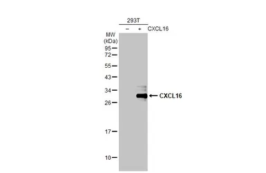 Anti-CXCL16 antibody [GT516] used in Western Blot (WB). GTX632502