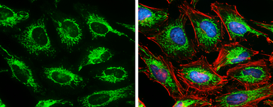 Anti-SDHA antibody [GT20710] used in Immunocytochemistry/ Immunofluorescence (ICC/IF). GTX632636