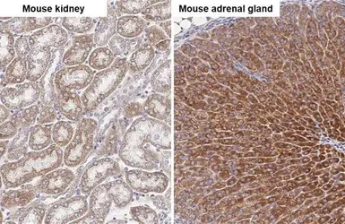 Anti-SDHA antibody [GT20710] used in IHC (Paraffin sections) (IHC-P). GTX632636