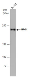 Anti-BRG1 antibody [GT2712] used in Western Blot (WB). GTX633391