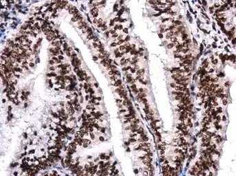 Anti-BRG1 antibody [GT2712] used in IHC (Paraffin sections) (IHC-P). GTX633391