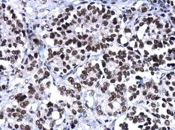 Anti-BRG1 antibody [GT2712] used in IHC (Paraffin sections) (IHC-P). GTX633391