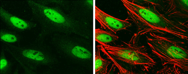 Anti-BRG1 antibody [GT2712] used in Immunocytochemistry/ Immunofluorescence (ICC/IF). GTX633391