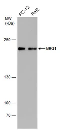 Anti-BRG1 antibody [GT2712] used in Western Blot (WB). GTX633391