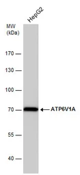 Anti-ATP6V1A antibody [GT3846] used in Western Blot (WB). GTX633542