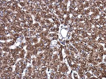 Anti-ATP6V1A antibody [GT3846] used in IHC (Paraffin sections) (IHC-P). GTX633542