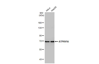 Anti-ATP6V1A antibody [GT811] used in Western Blot (WB). GTX633543