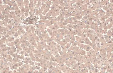 Anti-ATP6V1A antibody [GT811] used in IHC (Paraffin sections) (IHC-P). GTX633543