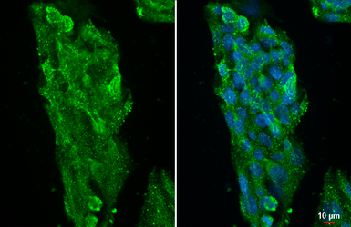 Anti-ATP6V1A antibody [GT811] used in Immunocytochemistry/ Immunofluorescence (ICC/IF). GTX633543