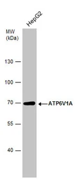 Anti-ATP6V1A antibody [GT1561] used in Western Blot (WB). GTX633544