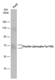 Anti-Paxillin (phospho Tyr118) antibody [GT712] used in Western Blot (WB). GTX633633