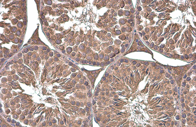 Anti-Paxillin (phospho Tyr118) antibody [GT712] used in IHC (Paraffin sections) (IHC-P). GTX633633