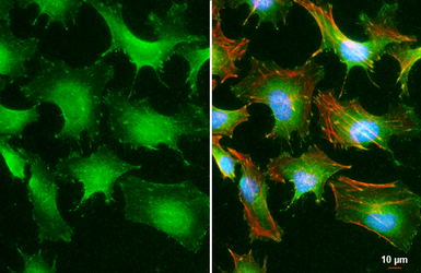 Anti-Paxillin (phospho Tyr118) antibody [GT712] used in Immunocytochemistry/ Immunofluorescence (ICC/IF). GTX633633