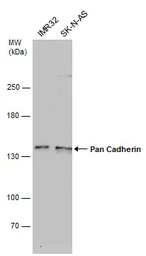 Anti-pan Cadherin antibody [GT2610] used in Western Blot (WB). GTX633689