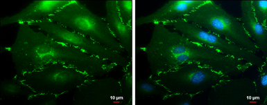 Anti-VE-Cadherin antibody [GT1369] used in Immunocytochemistry/ Immunofluorescence (ICC/IF). GTX633705