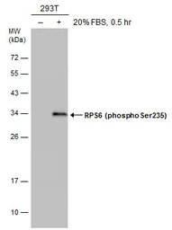 Anti-RPS6 (phospho Ser235) antibody [GT829] used in Western Blot (WB). GTX633823