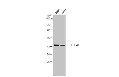 Anti-TDP43 antibody [GT6310] used in Western Blot (WB). GTX633973