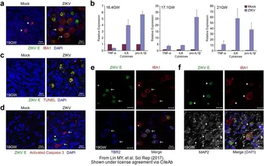 Anti-Zika virus Envelope protein antibody [GT363] used in Immunocytochemistry/ Immunofluorescence (ICC/IF). GTX634155