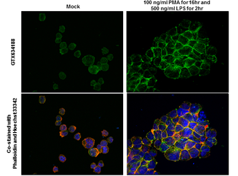 Anti-IL1 beta antibody [GT289] used in Immunocytochemistry/ Immunofluorescence (ICC/IF). GTX634188