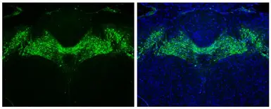 Anti-Tyrosine Hydroxylase antibody [GT234] used in IHC (Paraffin sections) (IHC-P). GTX634481