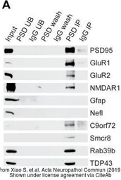 Anti-C9orf72 antibody [GT1553] used in Western Blot (WB). GTX634482