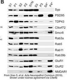 Anti-C9orf72 antibody [GT1553] used in Western Blot (WB). GTX634482