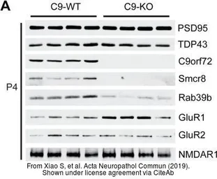 Anti-C9orf72 antibody [GT1553] used in Western Blot (WB). GTX634482