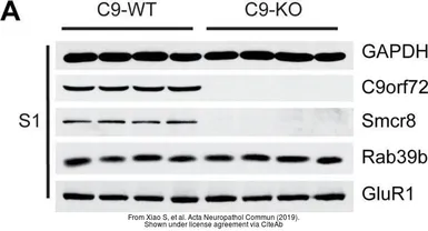 Anti-C9orf72 antibody [GT1553] used in Western Blot (WB). GTX634482