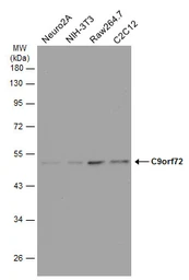 Anti-C9orf72 antibody [GT1553] used in Western Blot (WB). GTX634482