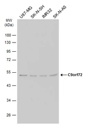 Anti-C9orf72 antibody [GT1553] used in Western Blot (WB). GTX634482