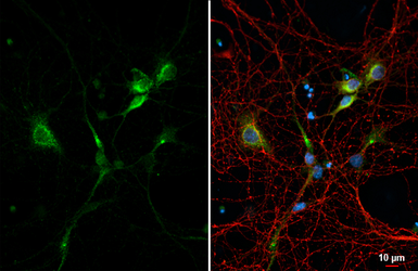 Anti-C9orf72 antibody [GT1553] used in Immunocytochemistry/ Immunofluorescence (ICC/IF). GTX634482