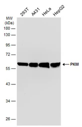 Anti-PKM antibody [GT1810] used in Western Blot (WB). GTX634796