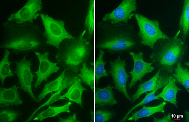 Anti-PKM antibody [GT1810] used in Immunocytochemistry/ Immunofluorescence (ICC/IF). GTX634796