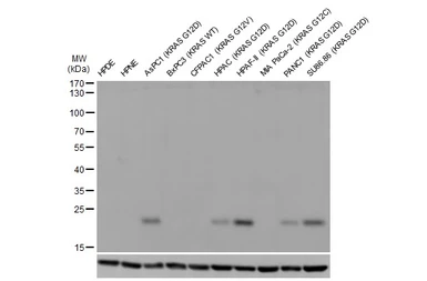 Anti-RAS (G12D Mutant) antibody [HL10] used in Western Blot (WB). GTX635362