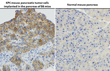 Anti-RAS (G12D Mutant) antibody [HL10] used in IHC (Paraffin sections) (IHC-P). GTX635362