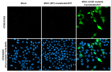 Anti-RAS (G12D Mutant) antibody [HL10] used in Immunocytochemistry/ Immunofluorescence (ICC/IF). GTX635362