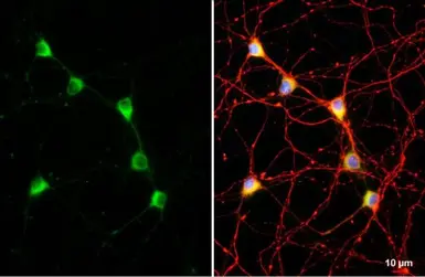 Anti-C9orf72 antibody [GT779-RB] used in Immunocytochemistry/ Immunofluorescence (ICC/IF). GTX635397