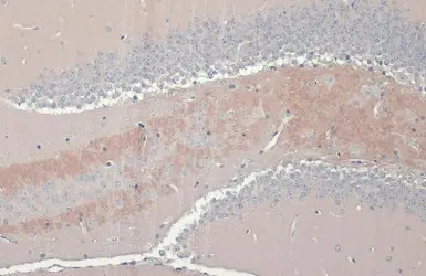 Anti-C9orf72 antibody [GT779-RB] used in IHC (Paraffin sections) (IHC-P). GTX635397