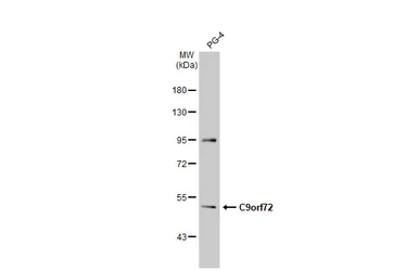 Anti-C9orf72 antibody [GT779-RB] used in Western Blot (WB). GTX635397