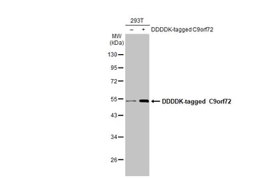 Anti-C9orf72 antibody [GT779-RB] used in Western Blot (WB). GTX635397