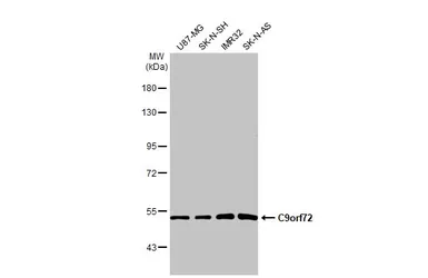 Anti-C9orf72 antibody [GT779-RB] used in Western Blot (WB). GTX635397