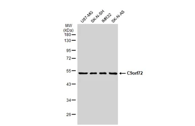 Anti-C9orf72 antibody [GT1553-RB] used in Western Blot (WB). GTX635398