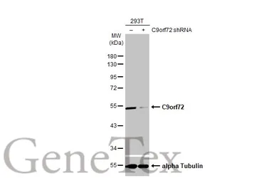 Anti-C9orf72 antibody [GT1553-RB] used in Western Blot (WB). GTX635398