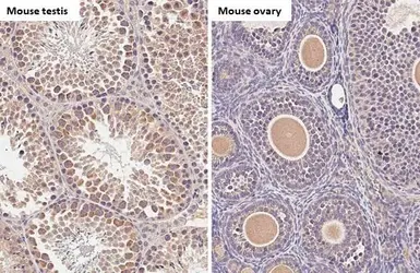 Anti-C9orf72 antibody [GT1553-RB] used in IHC (Paraffin sections) (IHC-P). GTX635398