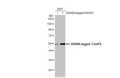 Anti-C9orf72 antibody [GT1553-RB] used in Western Blot (WB). GTX635398