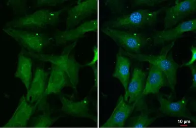 Anti-ERK1 (phospho Thr202/Tyr204) + ERK2 (phospho Thr185/Tyr187) antibody [HL173] used in Immunocytochemistry/ Immunofluorescence (ICC/IF). GTX635617