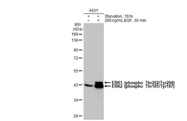 Anti-ERK1 (phospho Thr202/Tyr204) + ERK2 (phospho Thr185/Tyr187) antibody [HL173] used in Western Blot (WB). GTX635617