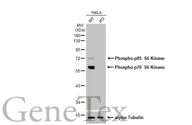 Anti-p70 S6K (phospho Thr421/Ser424) antibody [HL129] used in Western Blot (WB). GTX635621